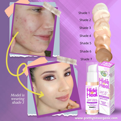 Hide and Heel Foundation
